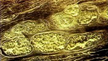 Examinar cómo una capa de grasa subcutánea suministra nutrientes al tejido conectivo denso y a las células epiteliales.